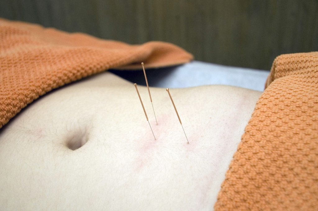 acupuncture pour perdre du ventre